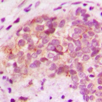 BRP44L Rabbit Polyclonal Antibody