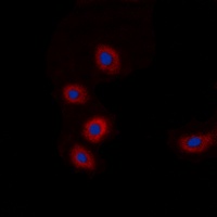 BRP44L Rabbit Polyclonal Antibody