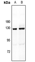 MYBPC1 Rabbit Polyclonal Antibody