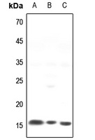NCALD Rabbit Polyclonal Antibody