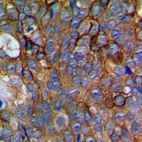 NCALD Rabbit Polyclonal Antibody