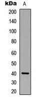 p40 phox Rabbit Polyclonal Antibody