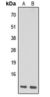 NDUFA1 Rabbit Polyclonal Antibody