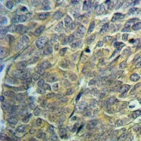 NDUFA1 Rabbit Polyclonal Antibody