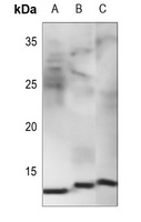 NDUFB1 Rabbit Polyclonal Antibody