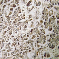 NDUFB1 Rabbit Polyclonal Antibody