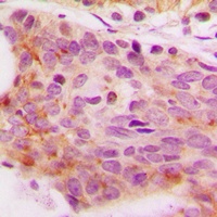NFAT4 (Phospho-S165) Antibody