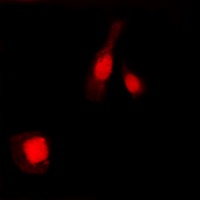 NF-kappaB p105/p50 (Phospho-S337) Antibody