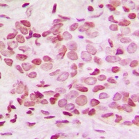 NF-kappaB p100 (Phospho-S865) Antibody