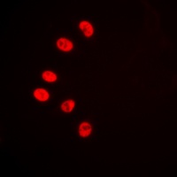 NR2F2 Rabbit Polyclonal Antibody