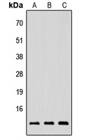 NRG4 Rabbit Polyclonal Antibody