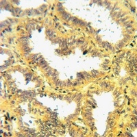 NRG4 Rabbit Polyclonal Antibody