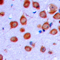 OLFML2A Rabbit Polyclonal Antibody