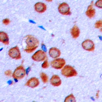 OLFML2B Rabbit Polyclonal Antibody
