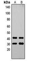 OVOL1 Rabbit Polyclonal Antibody