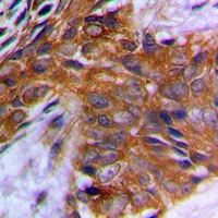 PAK1 (Phospho-T212) Antibody
