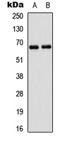 PAK1 Rabbit Polyclonal Antibody