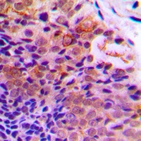 PDCD4 (Phospho-S457) Antibody