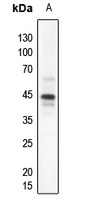 PDHA1 Rabbit Polyclonal Antibody