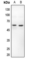 PFKFB2 Antibody