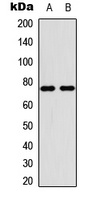 PIAS4 Rabbit Polyclonal Antibody