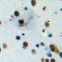 PIAS4 Rabbit Polyclonal Antibody