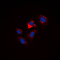 Phospholamban (Phospho-S16/T17) Antibody