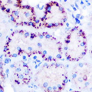 ANGPTL4 Rabbit Polyclonal Antibody
