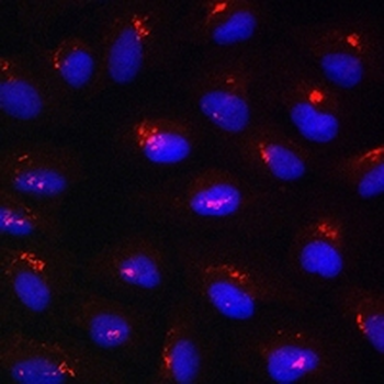 ANGPTL4 Rabbit Polyclonal Antibody