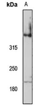 VPS13A Rabbit Polyclonal Antibody