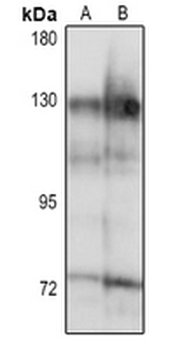 TRAK1 Rabbit Polyclonal Antibody
