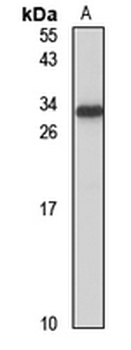TMEM147 Rabbit Polyclonal Antibody