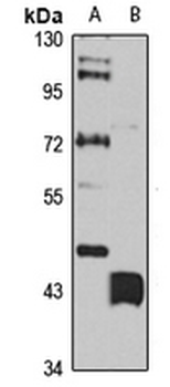 SLC27A6 Rabbit Polyclonal Antibody