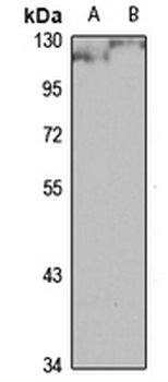 PRICKLE2 Rabbit Polyclonal Antibody