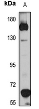 PPP1R3A Rabbit Polyclonal Antibody