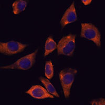CD210b Rabbit Polyclonal Antibody