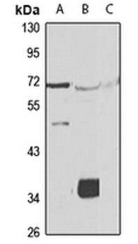 ALG1 Rabbit Polyclonal Antibody