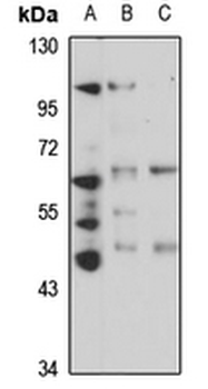ACD Rabbit Polyclonal Antibody