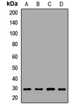 SPIN2B Rabbit Polyclonal Antibody
