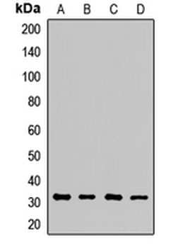 ECHS1 Rabbit Polyclonal Antibody
