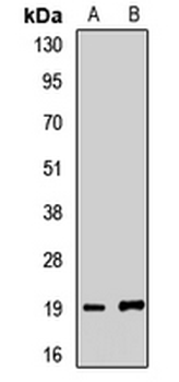 Gemin6 Rabbit Polyclonal Antibody