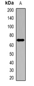 SOAT1 Rabbit Polyclonal Antibody