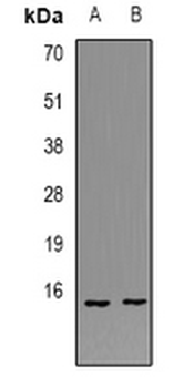 POLR1D Rabbit Polyclonal Antibody