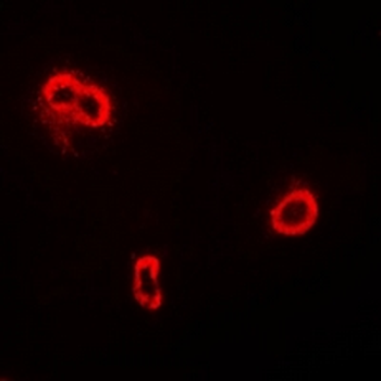 FRZB Rabbit Polyclonal Antibody