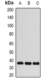 ALKBH3 Rabbit Polyclonal Antibody