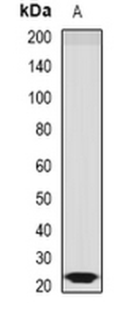Sorcin Rabbit Polyclonal Antibody
