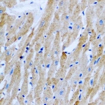Sorcin Rabbit Polyclonal Antibody