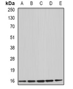 Uev1A Rabbit Polyclonal Antibody