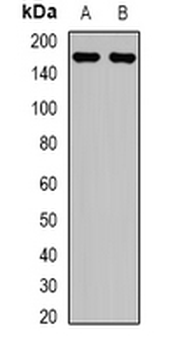 LRP5 Rabbit Polyclonal Antibody