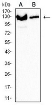 XPC Mouse Monoclonal Antibody